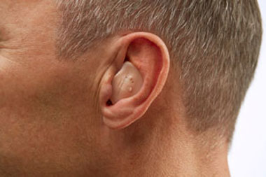 In the Ear - Hearing Aids - Nardelli Audiology